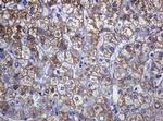 SOAT2 Antibody in Immunohistochemistry (Paraffin) (IHC (P))