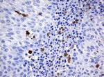 HOXD10 Antibody in Immunohistochemistry (Paraffin) (IHC (P))