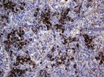 MAGEA3 Monoclonal Antibody (OTI1G9)