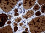WFDC2 Antibody in Immunohistochemistry (Paraffin) (IHC (P))