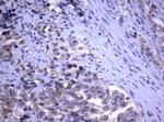 RASGRP3 Monoclonal Antibody (OTI2G7)