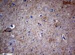 VSNL1 Antibody in Immunohistochemistry (Paraffin) (IHC (P))