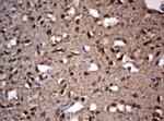 VSNL1 Antibody in Immunohistochemistry (Paraffin) (IHC (P))