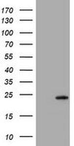 VSNL1 Antibody in Western Blot (WB)