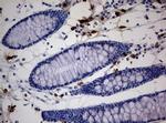 PEG3 Antibody in Immunohistochemistry (Paraffin) (IHC (P))