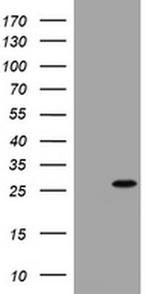 BNIP1 Antibody in Western Blot (WB)