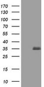 TGIF Antibody in Western Blot (WB)
