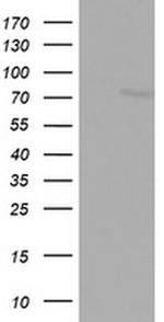 FBXO11 Monoclonal Antibody (OTI1F6)