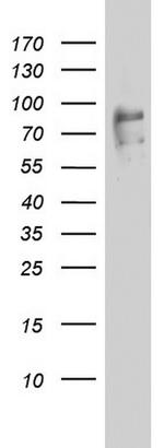 FBXO11 Antibody in Western Blot (WB)