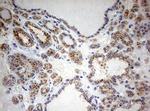 SPATA2L Antibody in Immunohistochemistry (Paraffin) (IHC (P))
