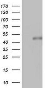 SPATA2L Antibody in Western Blot (WB)