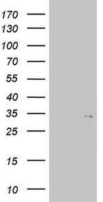 TGIF Antibody in Western Blot (WB)