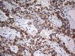 FEN1 Antibody in Immunohistochemistry (Paraffin) (IHC (P))