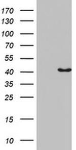 Pleckstrin 2 Monoclonal Antibody (OTI5D3)