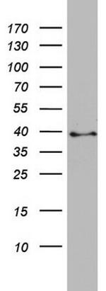 Pleckstrin 2 Antibody in Western Blot (WB)