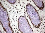 FBXW7 Antibody in Immunohistochemistry (Paraffin) (IHC (P))