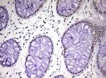 CDCA7L Antibody in Immunohistochemistry (Paraffin) (IHC (P))