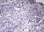 CDCA7L Antibody in Immunohistochemistry (Paraffin) (IHC (P))