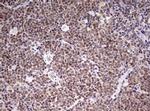 CDCA7L Antibody in Immunohistochemistry (Paraffin) (IHC (P))