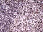 CDCA7L Antibody in Immunohistochemistry (Paraffin) (IHC (P))