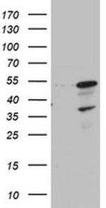 CDCA7L Antibody in Western Blot (WB)