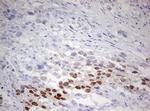 TIPIN Antibody in Immunohistochemistry (Paraffin) (IHC (P))