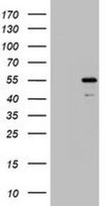 TIPIN Antibody in Western Blot (WB)