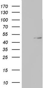 TIPIN Antibody in Western Blot (WB)