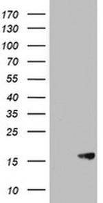 AVPI1 Monoclonal Antibody (OTI6C5)