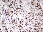 CDCA7L Antibody in Immunohistochemistry (Paraffin) (IHC (P))