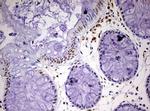 CDCA7L Antibody in Immunohistochemistry (Paraffin) (IHC (P))