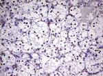 CDCA7L Antibody in Immunohistochemistry (Paraffin) (IHC (P))