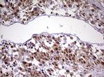 CDCA7L Antibody in Immunohistochemistry (Paraffin) (IHC (P))