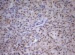 CDCA7L Antibody in Immunohistochemistry (Paraffin) (IHC (P))