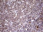 CDCA7L Antibody in Immunohistochemistry (Paraffin) (IHC (P))