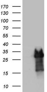 PRRX1 Antibody in Western Blot (WB)