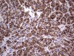 PRRX1 Antibody in Immunohistochemistry (Paraffin) (IHC (P))