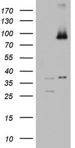 ABCD1 Antibody in Western Blot (WB)