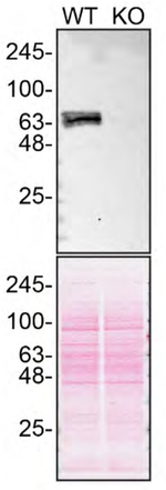 GBA Antibody in Western Blot (WB)