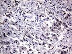 Macro H2A.2 Monoclonal Antibody (OTI1F5)