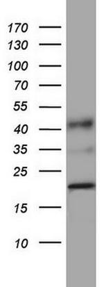 PPIH Antibody in Western Blot (WB)