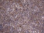 ZNF286A Antibody in Immunohistochemistry (Paraffin) (IHC (P))