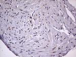 ZNF286A Antibody in Immunohistochemistry (Paraffin) (IHC (P))