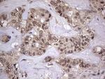 ZNF286A Antibody in Immunohistochemistry (Paraffin) (IHC (P))