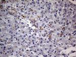 ABCD1 Monoclonal Antibody (OTI3A1)
