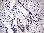 ZNF34 Antibody in Immunohistochemistry (Paraffin) (IHC (P))