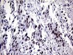 ZNF34 Antibody in Immunohistochemistry (Paraffin) (IHC (P))