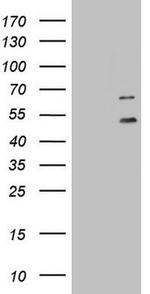 DDOST Antibody in Western Blot (WB)