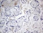 TACC2 Antibody in Immunohistochemistry (Paraffin) (IHC (P))
