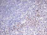 ITGB1BP1 Antibody in Immunohistochemistry (Paraffin) (IHC (P))